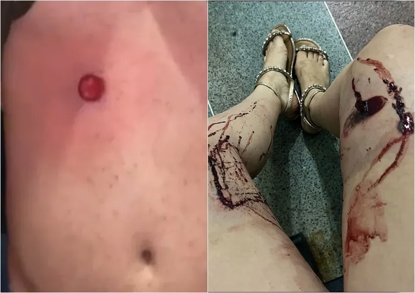 Advogado denuncia abuso de autoridade e agressão policial em evento político em Livramento de Nossa Senhora