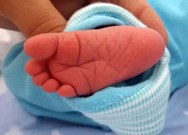 Anvisa autoriza registro de vacina que previne bronquiolite em bebês