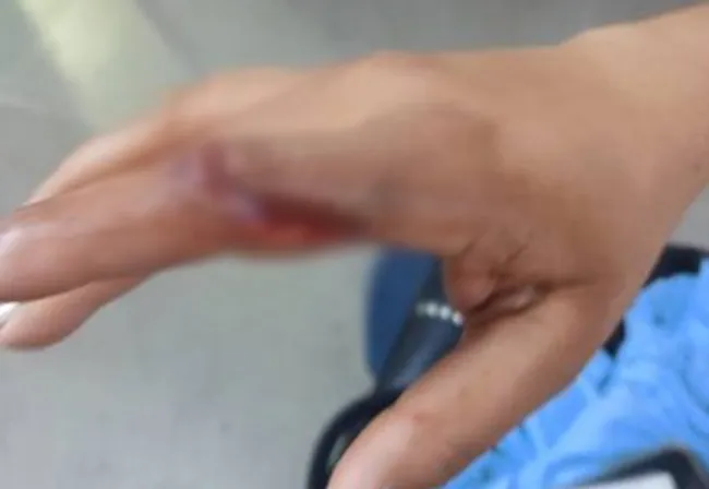 Mulher fica ferida durante ocorrência de violência doméstica na zona rural de Pindaí