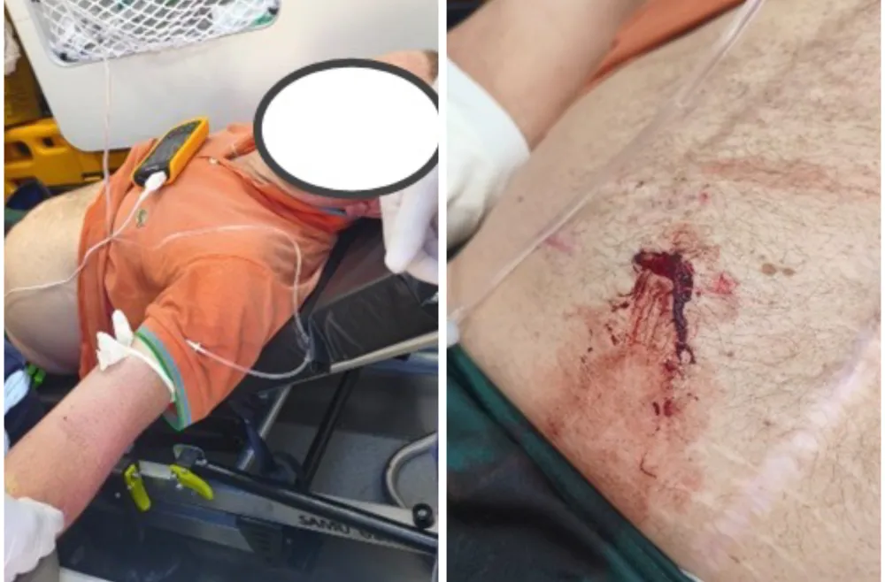 Homem em surto psicológico se automutila e é socorrido pelo SAMU com apoio da PM em Guanambi