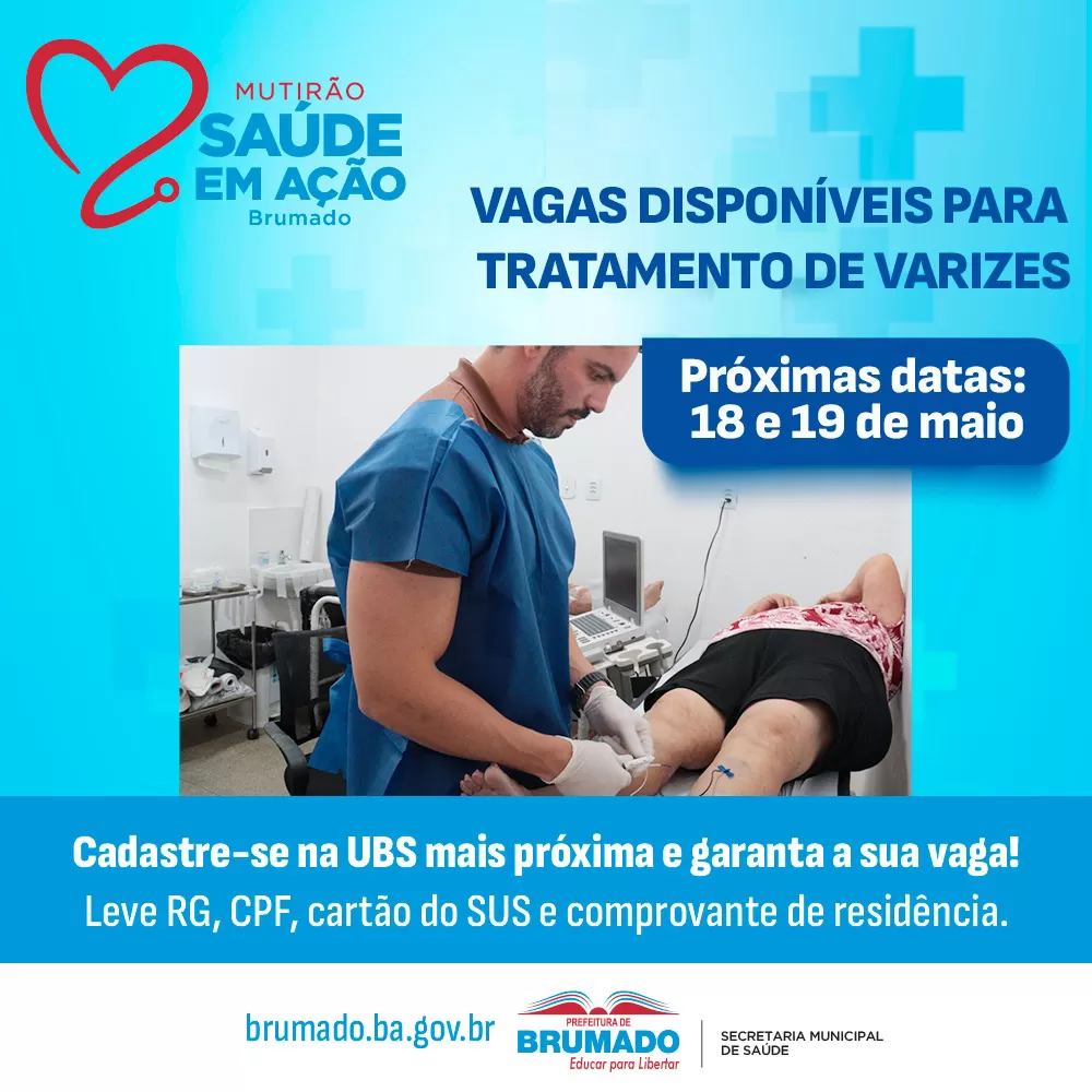 Brumado: Mutirão de Saúde tem novas datas para tratamento de varizes