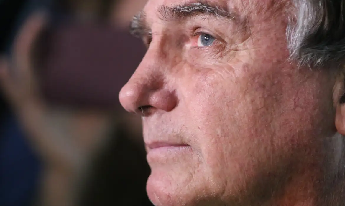 Após pedido de cirurgia, Alexandre de Moraes manda PF fazer perícia em Bolsonaro