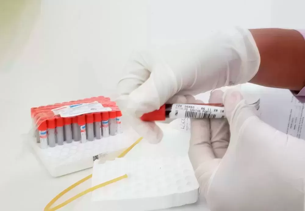 Lacen-BA lidera número de testes no Brasil, afirma Ministério da Saúde