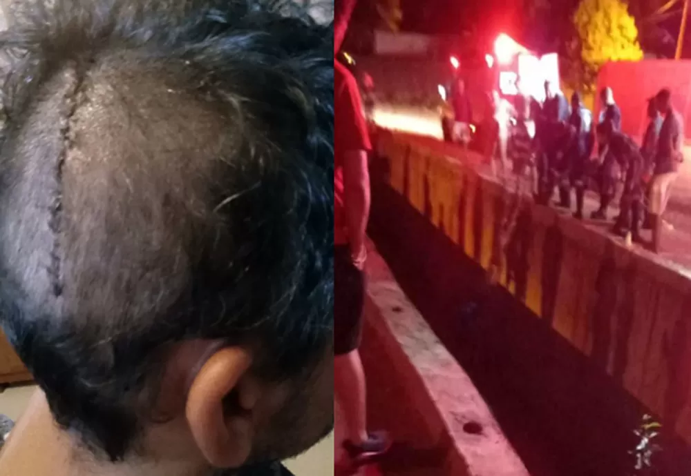 Prefeitura de Brumado é condenada a pagar indenização a pedestre que cai em riacho do bufão