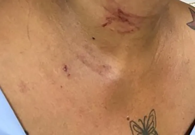 Ocorrência de agressão mobiliza Polícia Militar durante a madrugada em Guanambi