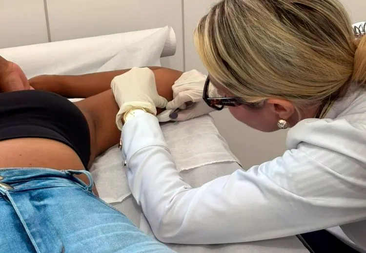 Saúde da mulher ganha reforço em Brumado com implante contraceptivo de longa duração nas UBS