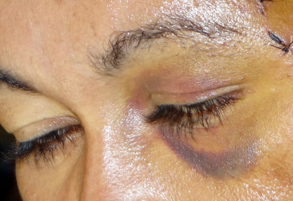 Câmara aprova projeto que agiliza adoção de medidas de proteção às mulheres