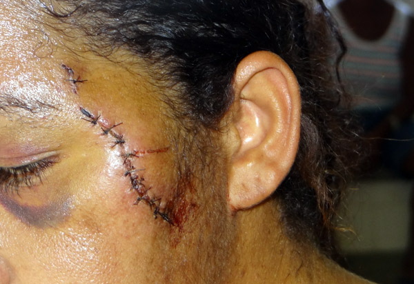 Mais de 500 mulheres são agredidas por hora no Brasil, revela pesquisa