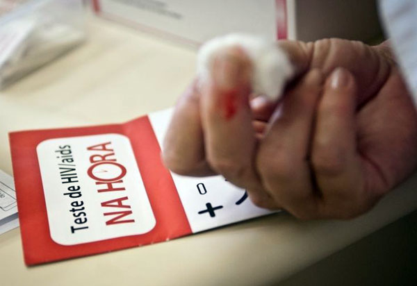 Bahia registra 736 novos casos de Aids em 2018; Salvador apresenta maior número