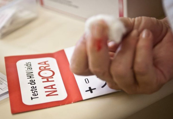 Aids: casos e óbitos caem 16% nos últimos quatro anos no Brasil