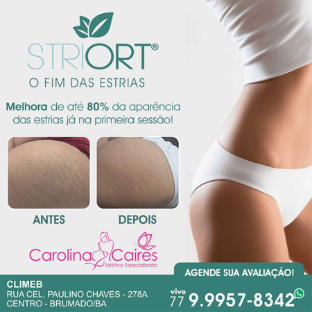  Carolina Caires - Estética Especializada: conheça o Striort e dê adeus as estrias