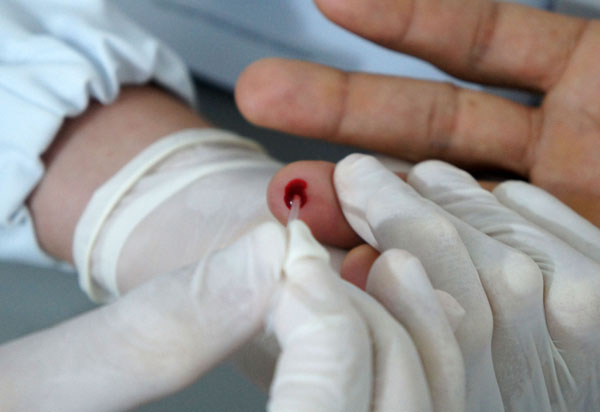 Julho: mês de luta, prevenção e controle das hepatites virais