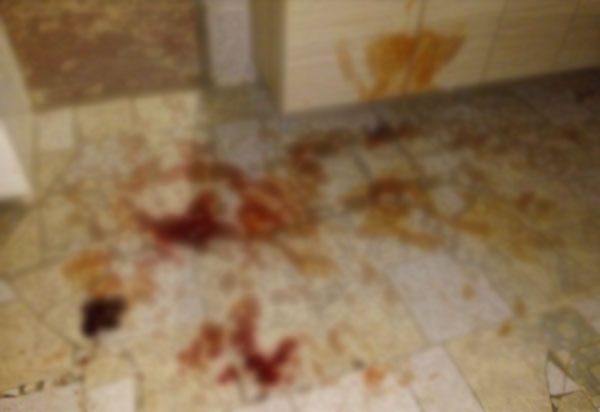 Brumado: Homem é morto a tiros e outro fica ferido