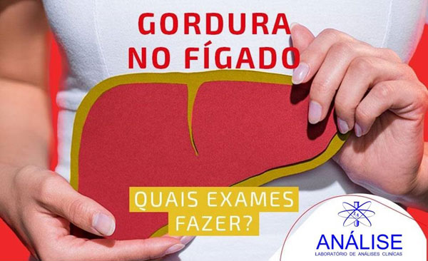 Informativo Laboratório Análise sobre gordura no fígado