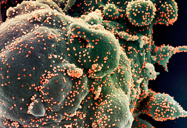 Ministério confirma cinco casos da variante Ômicron no Brasil