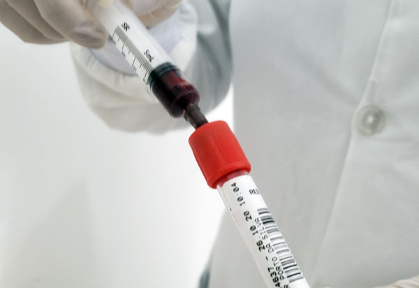 Lacen-BA conclui 225 sequenciamentos genéticos em pacientes com Covid-19 e confirma dispersão de variantes mais agressivas