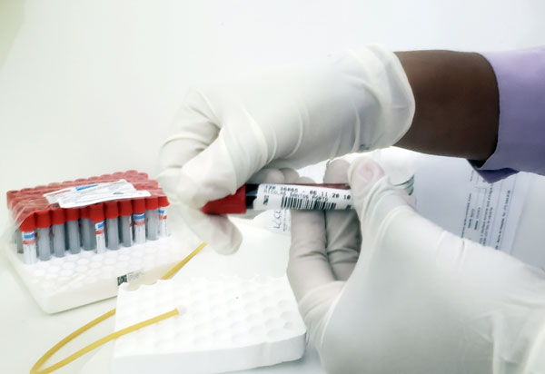 Variante Ômicron representa mais de 71% dos casos de coronavírus na Bahia