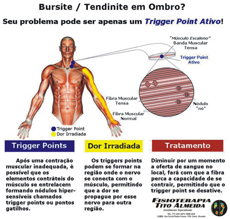 Fisioterapia Tito Almeida - Atendimento Especializado