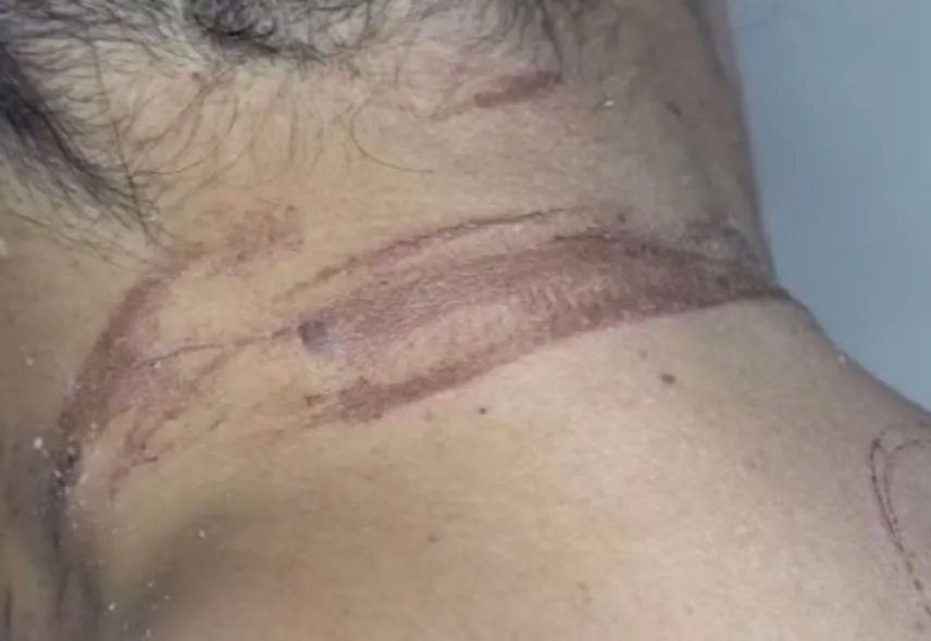 Mulher denuncia ter sido enterrada viva pelo ex-namorado em Itabuna