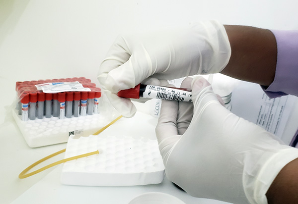 Brasil atinge marca de 400 mil mortos pela covid-19