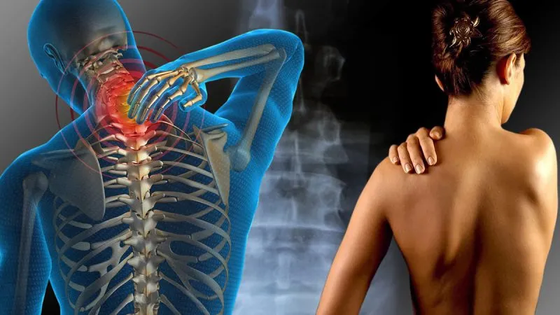 Nova Lei garante direitos aos portadores de Fibromialgia em Brumado