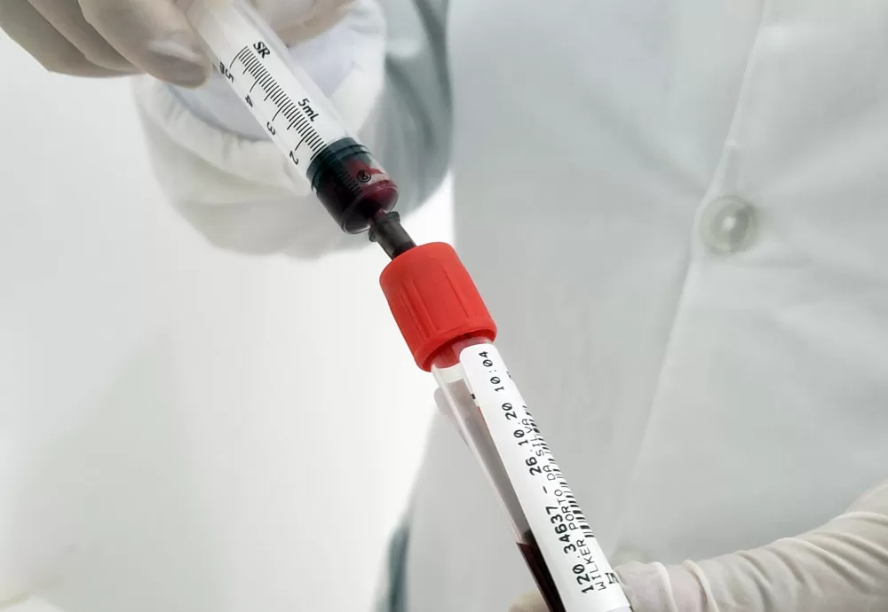 Bahia registra o segundo caso da variante Arcturus da Covid-19 no país