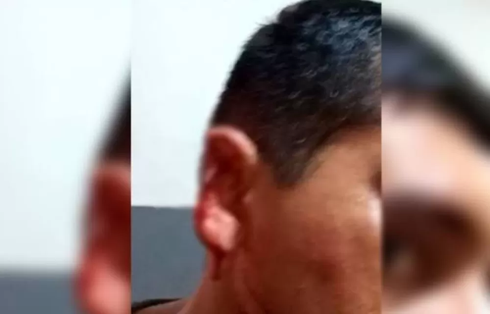 Malhada de Pedras: Homem tem orelha arrancada com mordida durante briga em bar