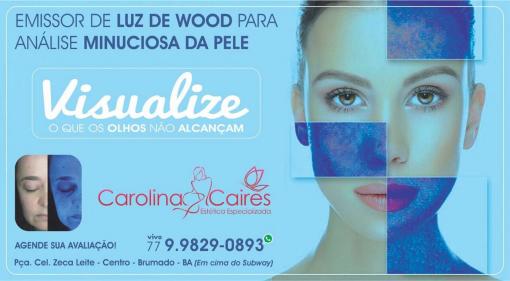 Carolina Caires Estética especializada: conheça os tratamentos para a região facial