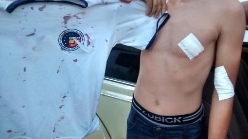 Brumado: Estudante do CMEAS sofre bullying e é ferido com estilete