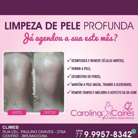 Carolina Caires Estética Especializada - Limpeza de pele profunda