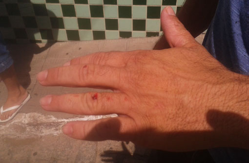 Brumado: Tampa de caixa de polietileno cai de prédio e atinge motociclista