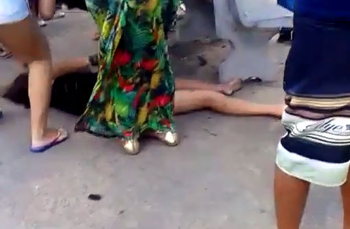 Brumado: Jovem fica em estado grave após acidente na Avenida Centenário