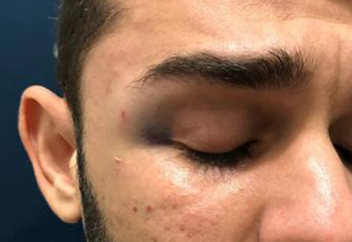 Livramento: assessor jurídico do município acusa policial militar de agressão 