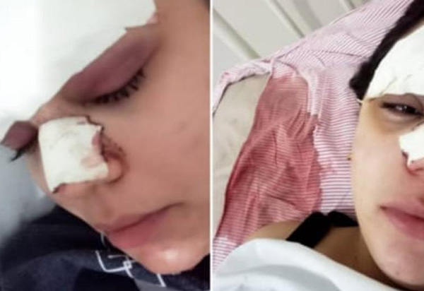 Barra da Estiva: Jovem tem cortes e hematomas no rosto após ser agredida e família denuncia amigo: 'Que não fique impune', diz irmã