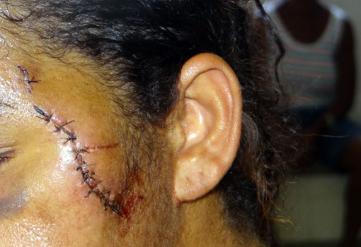 Número de mulheres que se declaram vítimas de violência cresceu nos últimos anos