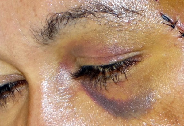 Condenados pela Lei Maria da Penha terão que ressarcir os cofres públicos