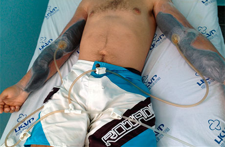 VCA: IMAGEN DO JOVEM QUE FEZ USO DE ANABOLIZANTES