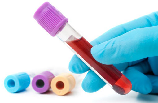 Bahia terá fábrica de medicamentos para Anemia Falciforme