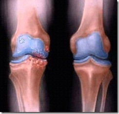 Fisioterapia Tito Almeida - Atendimento Especializado