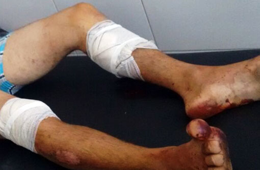 Brumado: Dois indivíduos assaltam transeunte, trocam tiros com a PM e são detidos