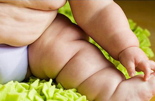 Obesidade e sobrepeso infantil aumentam 1.000% no Brasil em 40 anos, diz estudo