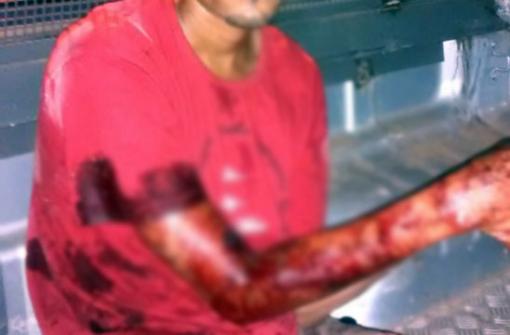 Brumado: Gari suspeito de roubo de motos e assaltos é alvejado durante perseguição policial