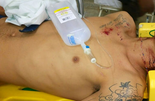 Livramento: Brumadense sofre tentativa de homicídio, outro homem também foi alvejado