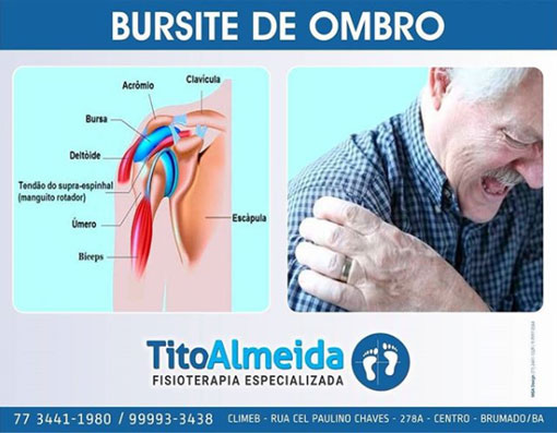 Tito Almeida - Fisioterapia Especializada