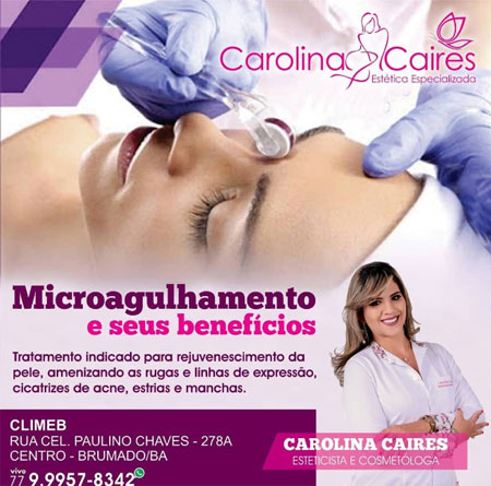 Carolina Caires Estética Especializada: conheça os benefícios do microagulhamento para a sua pele