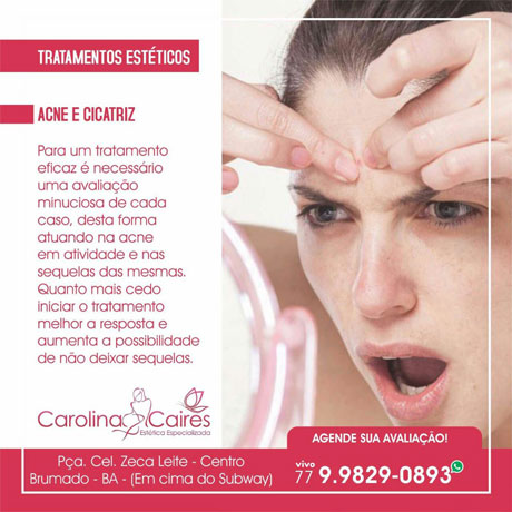 Carolina Caires - Estética Especializada