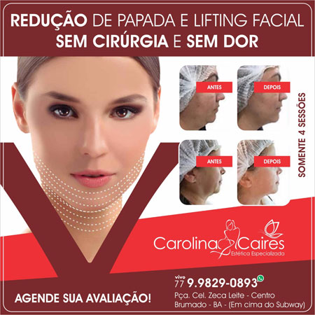 Carolina Caires Estética Especializada: conheça os benefícios do Lift Form