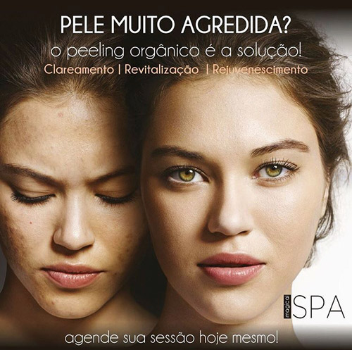 Carolina Caires - Estética Especializada: conheça os benefícios do Peeling Orgânico