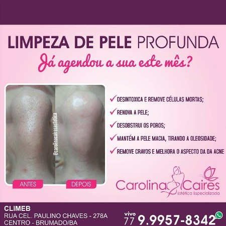 Carolina Caires Estética Especializada: faça limpeza de pele e mantenha sua pele linda
