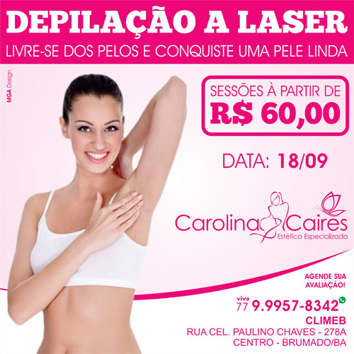  Carolina Caires - Estética Especializada: conheça os benefícios da depilação a laser